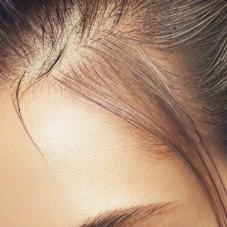Chute / Perte de cheveux