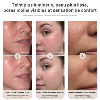 Ageless Pro™ 4-en-1 — L’appareil visage qui transforme votre routine