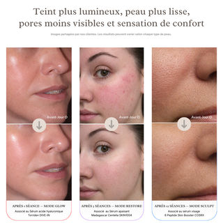 Ageless Pro™ 4-en-1 — L’appareil visage qui transforme votre routine